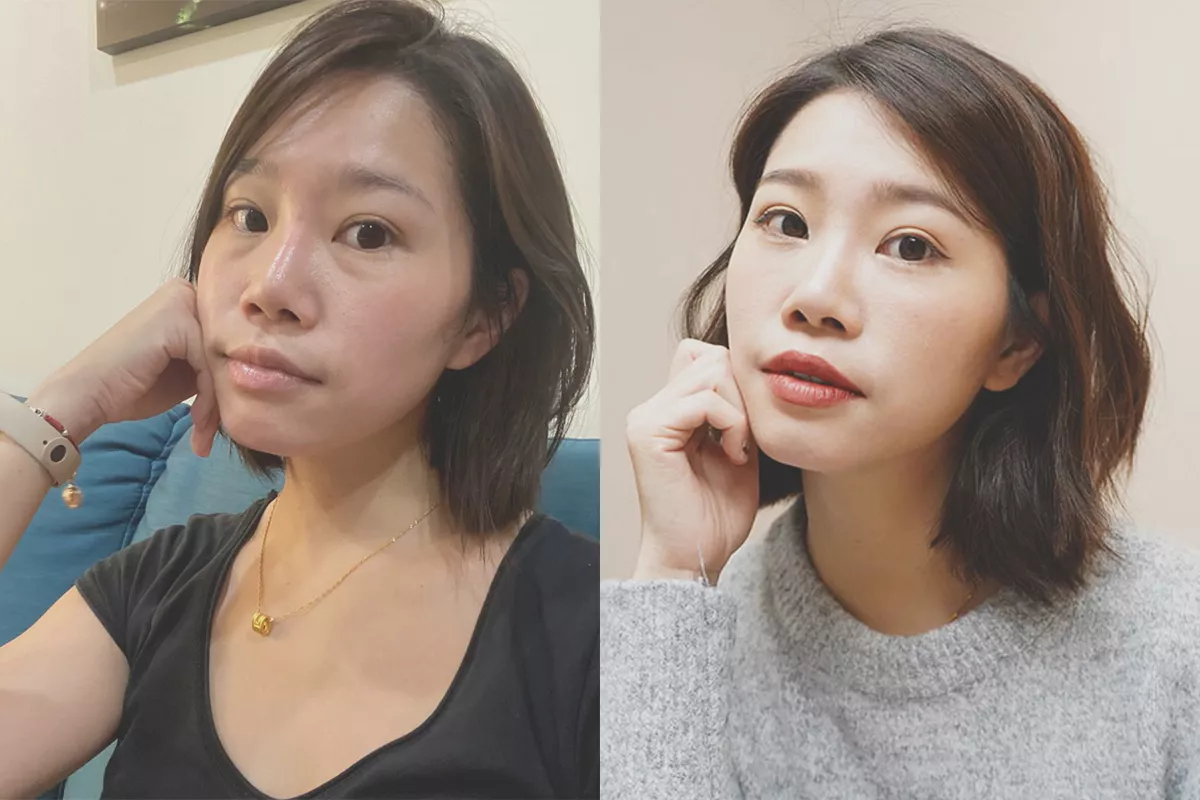 無痕眼袋&威萃補脂 | 掰掰眼袋與淚溝